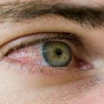 Alergias oculares afetam 20 por cento da população