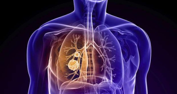 Doença Pulmonar Obstrutiva Crónica
