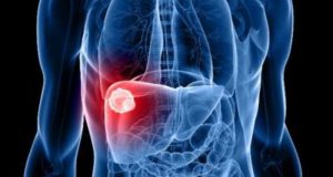 Dia Mundial de Luta contra as Hepatites