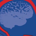 O AVC é a primeira causa de morte e incapacidade