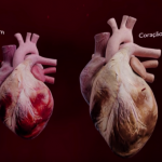 Gema Digital apresenta solução sobre o envelhecimento do coração