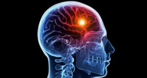 Dia Nacional do Doente com AVC assinala-se a 31 de março