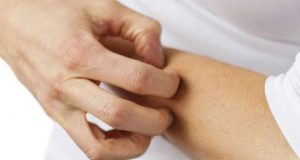 Dermatologistas debatem as doenças da pele em Portugal