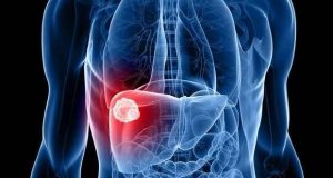 Médicos alertam para a prevenção do cancro do fígado