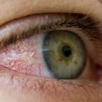 APLO exige formação superior para exercício da profissão