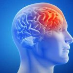 Abordagem na Fase Aguda do Acidente Vascular Cerebral