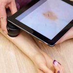 Cancros de pele provocados pela exposição solar