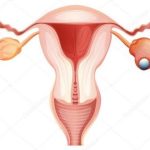 Cancro do ovário: o cancro silencioso que precisa de voz